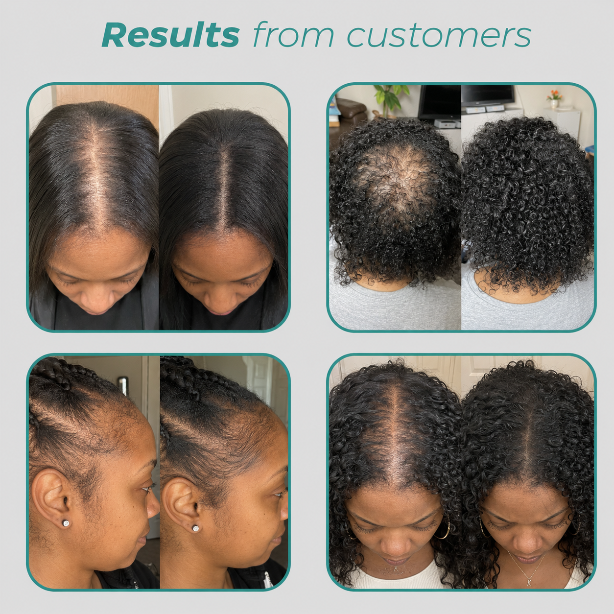 Collagen Mix - Anti-Shedding Formula